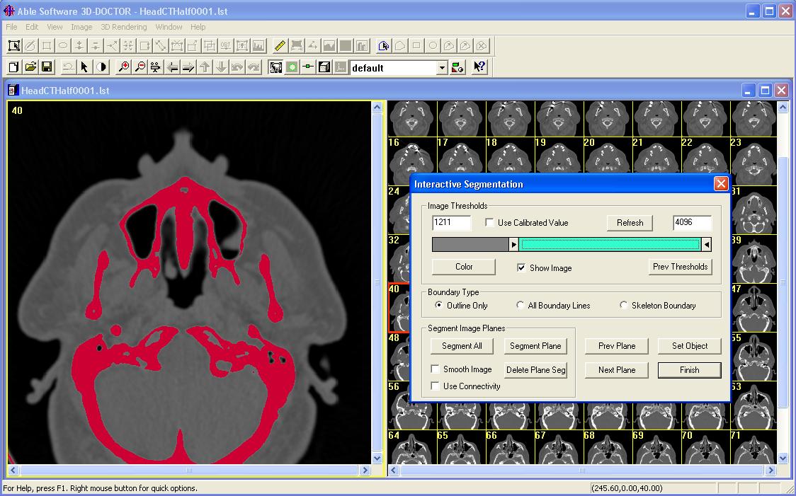 Interactive Segmentation